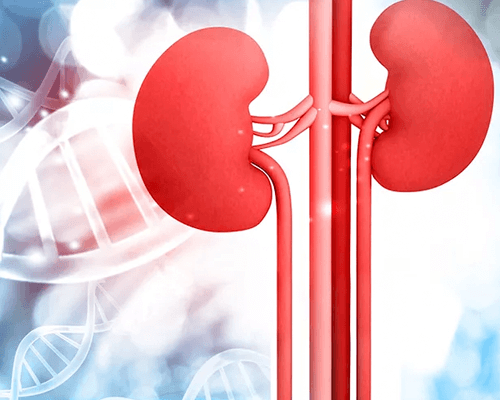 Nephrotic Syndrome